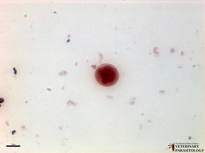 Balantidium coli cyst, fecal smear