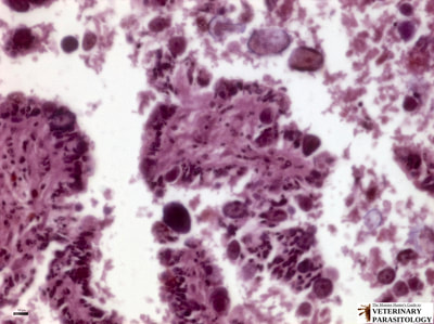 Coccidia infection of liver (i.e., hepatic coccidiosis), developing oocysts