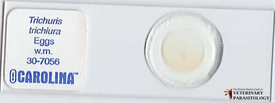 Trichuris trichiura eggs, fecal float