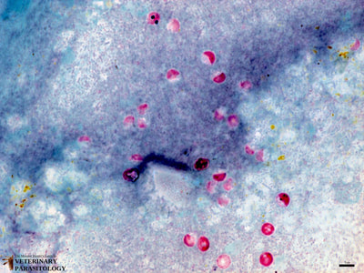 Cryptosporidium parvum oocysts in fecal smear