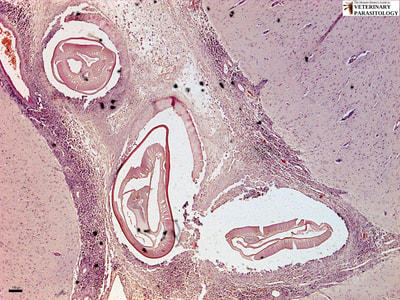 Dirofilaria immitis (heart worm) in brain (i.e., cerebral nematodiasis)