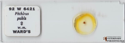 Pthirus pubis (aka., crab louse) adult female louse
