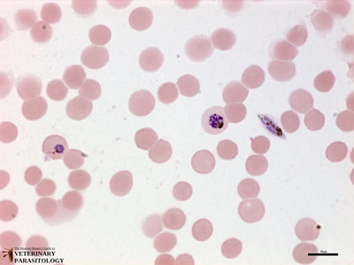 Plasmodium falciparum developing trophozoite, schizont, and gametocyte
