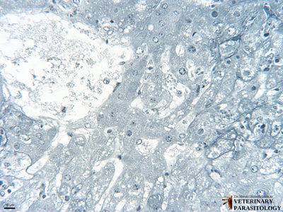 Toxoplasma gondii schizont and tachyzoites in liver (i.e., hepatic toxoplasmosis)