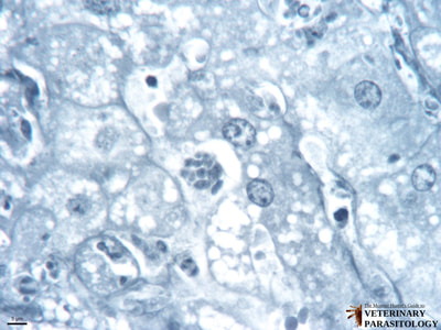 Toxoplasma gondii schizont and tachyzoites in liver (i.e., hepatic toxoplasmosis)
