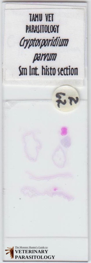 Cryptosporidium parvum in cross-section of small intestine