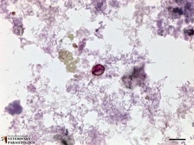Cyclospora sp. oocyst, stained fecal smear