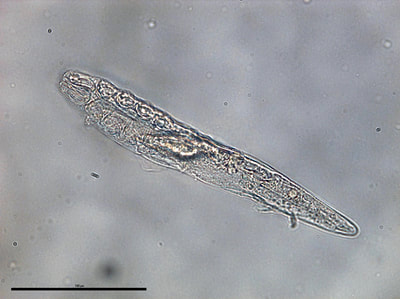 Demodex folliculorum (aka., human follicle mite)
