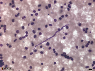 Dipetalonema perstans microfilaria