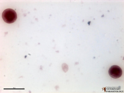 Balantidium coli cysts, fecal smear