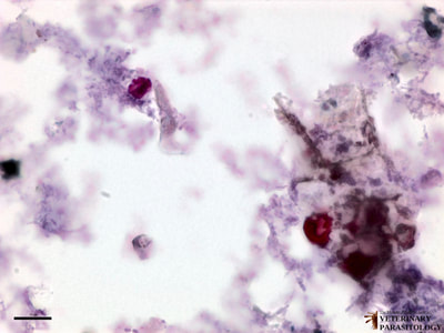 Cyclospora sp. oocysts, stained fecal smear