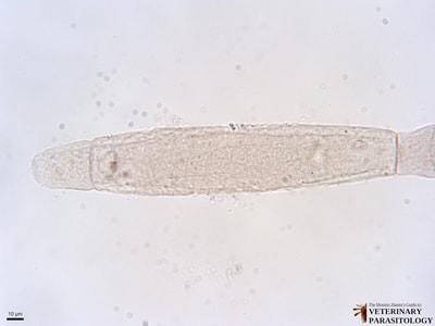 Gregarina sp. protozoan of invertebrates