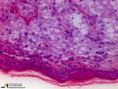 Leishmania mexicana amastigotes in skin biopsy