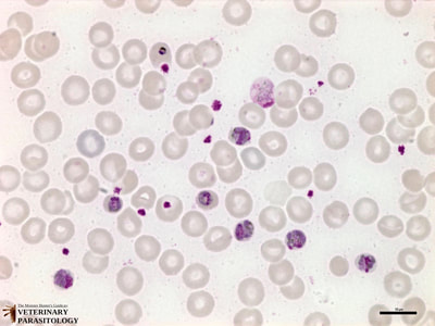 Plasmodium malariae trophozoites and gametocytes