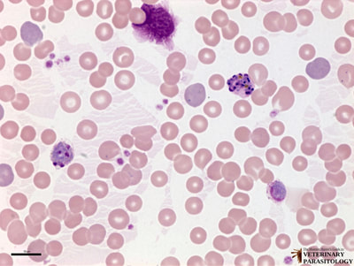 Plasmodium vivax schizonts and gametocyte