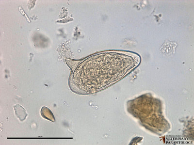 Schistosoma mansoni egg, fecal float