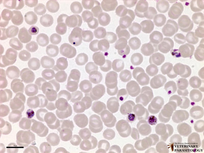 Plasmodium malariae trophozoites and gametocytes