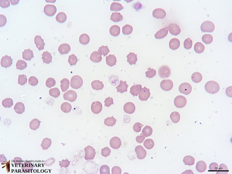 Stain precipitant artifact in a blood smear.