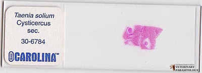 Taenia solium cysticercus (aka., Cysticercus cellulosae)