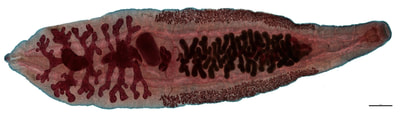 Clonorchis sinensis fluke parasite