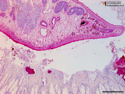Fasciola hepatica in bile duct