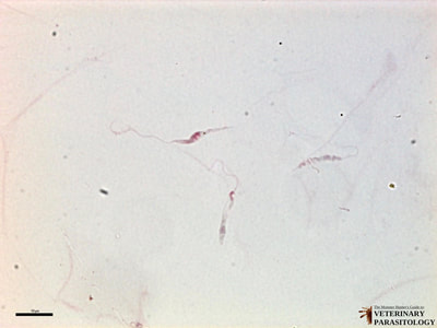 Leishmania donovani promastigotes, blood smear