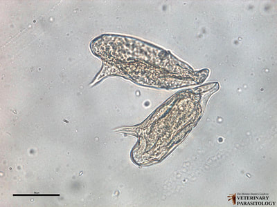 Schistosoma mansoni eggs, fecal float