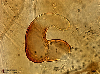 Spermatheca of Xenopsylla cheopis (aka., Oriental Rat Flea)