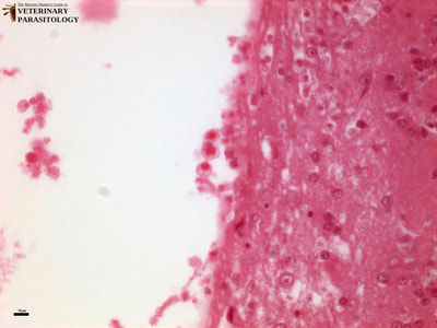 Naegleria fowleri trophozoites in cerebrum