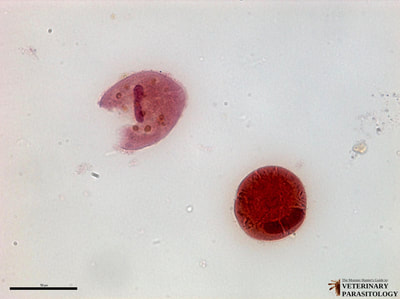 Balantidium coli trophozoite and cyst, fecal smear