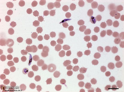 Plasmodium falciparum developing trophozoite and gametocytes