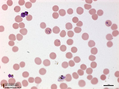 Plasmodium falciparum schizonts, ring-form trophozoites, and gametocyte