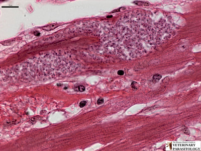 Trypanosoma cruzi amastigotes in cardiac muscle