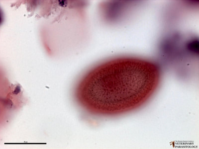 Capillaria hepatica eggs in liver