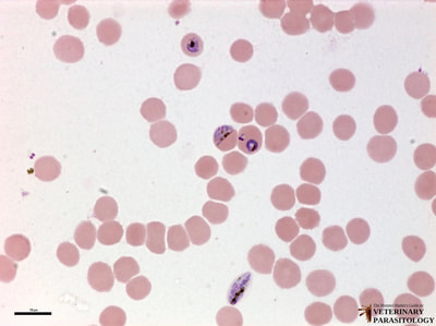 Plasmodium falciparum trophozoites and gametocytes