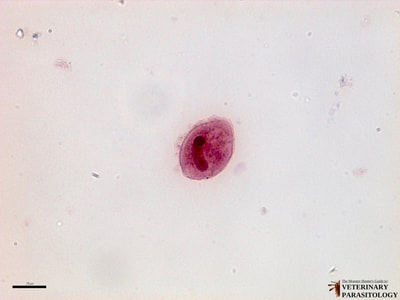 Balantidium coli trophozoite, fecal smear