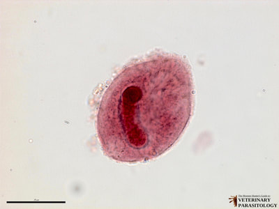Balantidium coli trophozoite, fecal smear