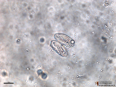 Enterobius vermicularis eggs, fecal float