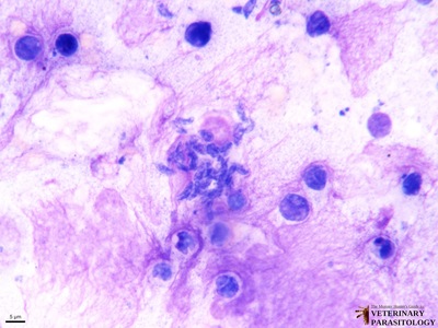 Toxoplasma gondii tachyzoites, smear; toxoplasmosis