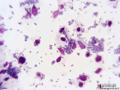 Toxoplasma gondii tachyzoites, smear; toxoplasmosis