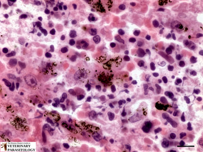 Entamoeba histolytica in liver