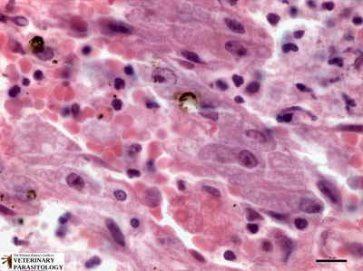 Entamoeba histolytica in liver