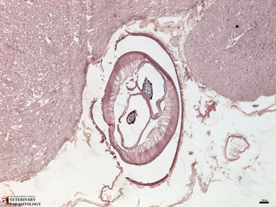 Dirofilaria immitis (heart worm) in brain (i.e., cerebral nematodiasis)