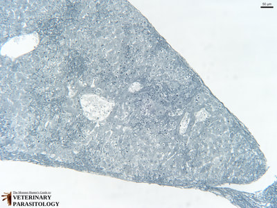 Toxoplasma gondii in liver (i.e., hepatic toxoplasmosis)