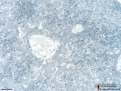 Toxoplasma gondii in liver (i.e., hepatic toxoplasmosis)