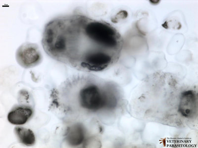 Invaginated protoscolex and calcareous corpuscles of Echinococcus granulosus hydatid sand