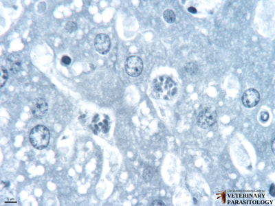 Toxoplasma gondii schizonts in liver (i.e., hepatic toxoplasmosis)